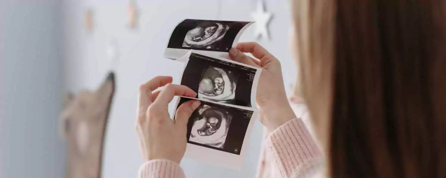 Первый триместр беременности фото | Впервые мама